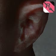 33